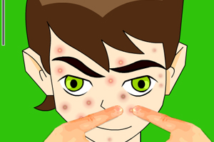 少年骇客挤痘痘