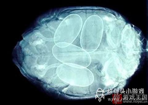 为避免化疗导致不孕？2岁女童冷冻卵子