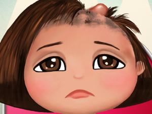 小朵拉治疗脱发