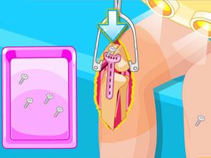 芭比的膝盖手术