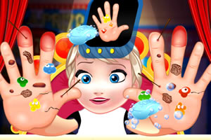 治疗艾尔莎的手