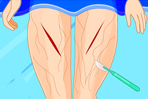 艾拉的腿部整形手术