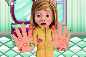 医治受伤的手部