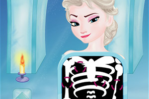 艾莎骨折修复术