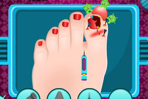 坏指甲护理医生