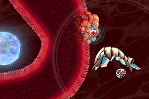 微型治疗机器人